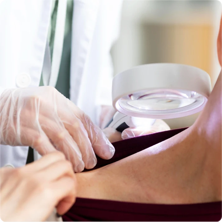 Superficial Radiation Therapy for Skin Cancer | Campbell Dermatology
