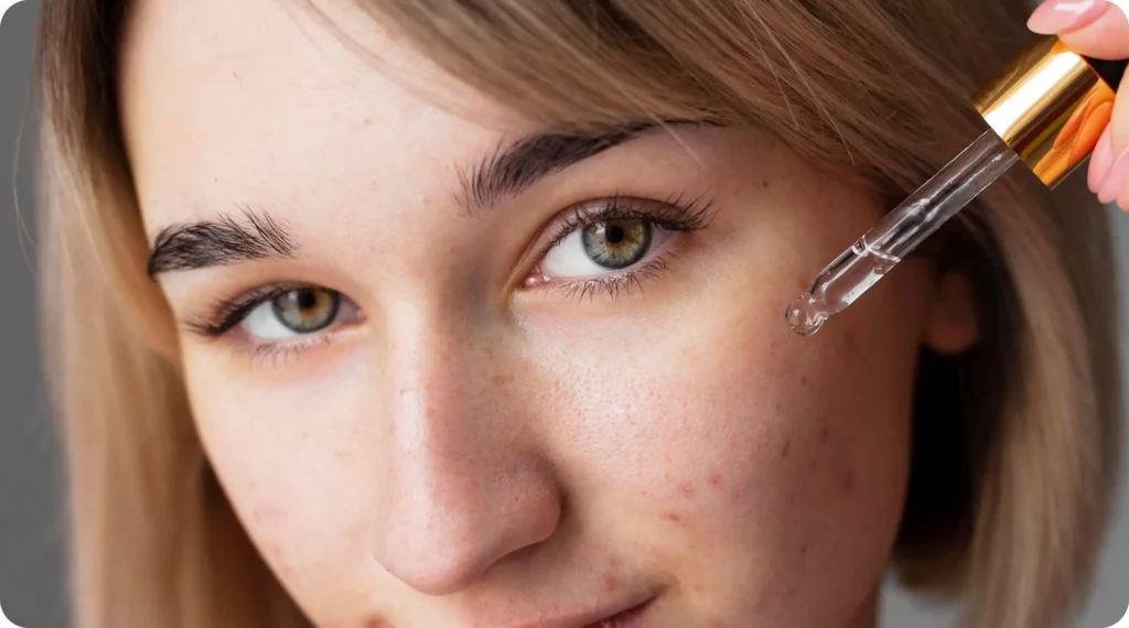 contact dermatitis treatment