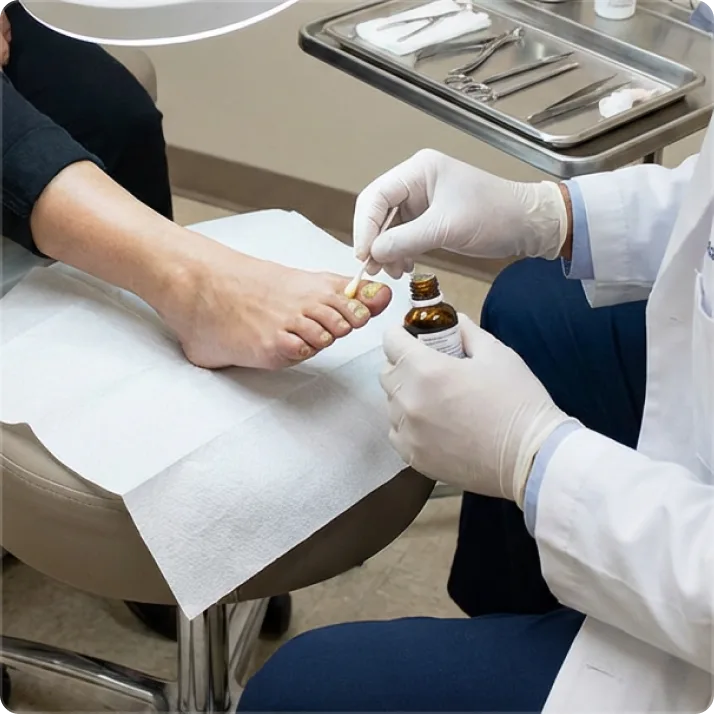 Ingrown nails Treatment in McMinnville