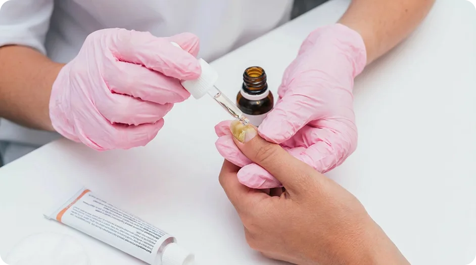 Ingrown nails Treatment in McMinnville