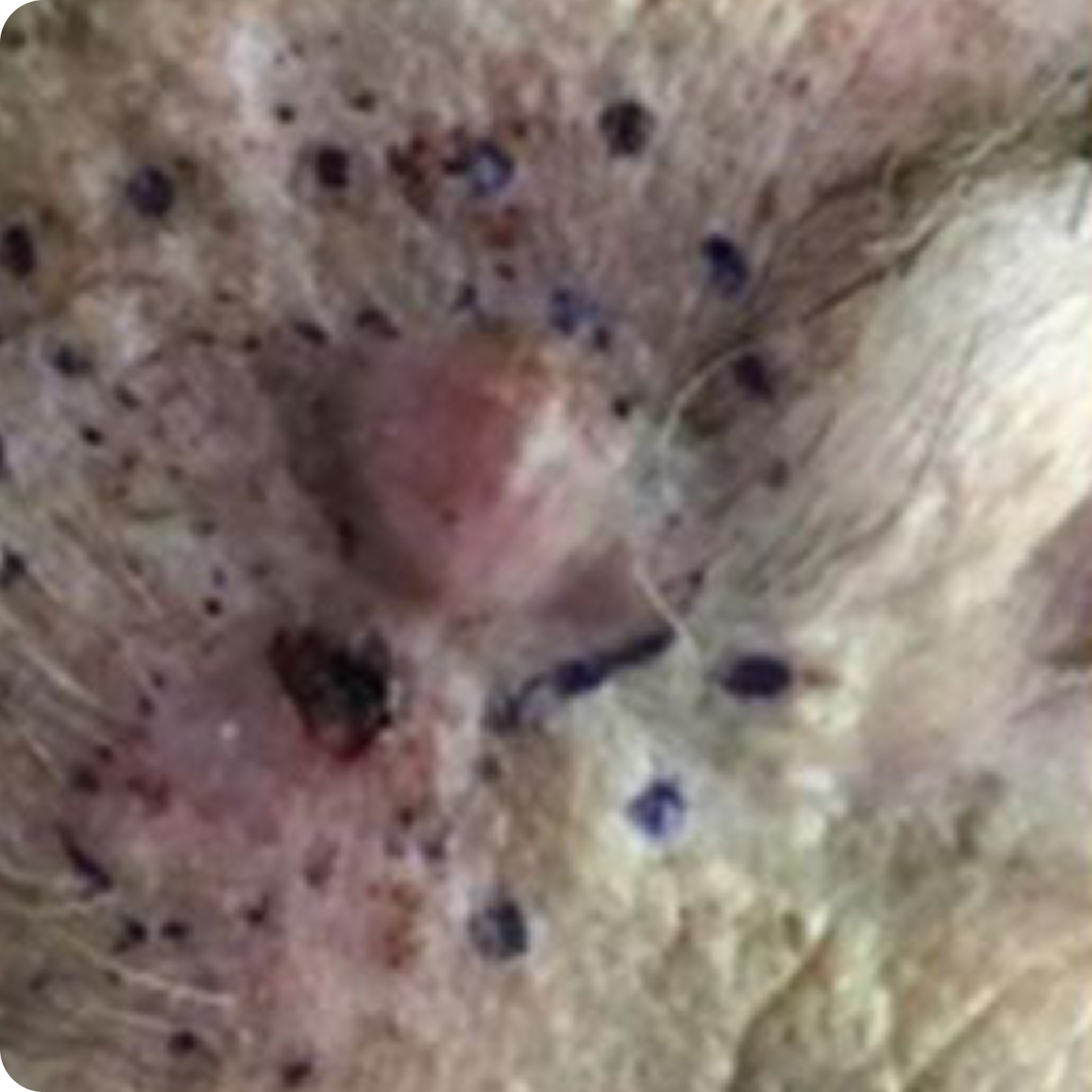 Superficial Radiation Therapy for Skin Cancer | Campbell Dermatology