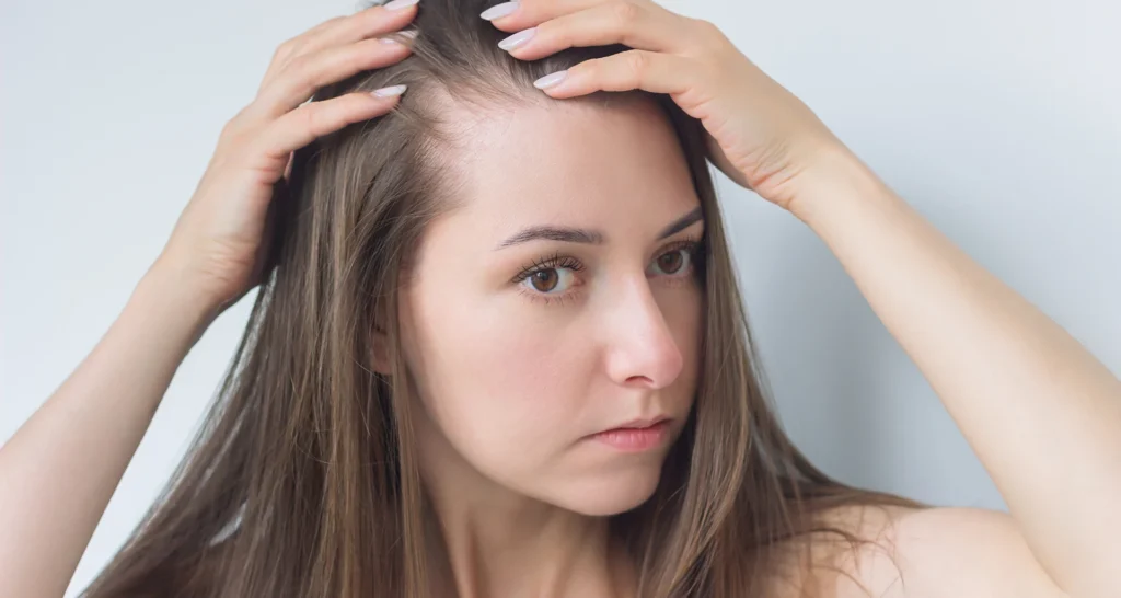 alopecia areata treatment