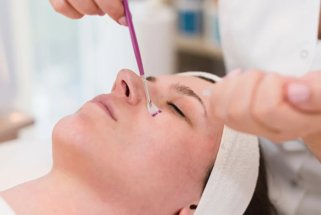 dermaplaning treatment mcminnville oregon