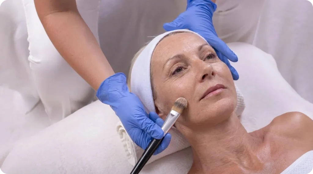 Chemical Peels | Smoother, Brighter Skin – Campbell Dermatology