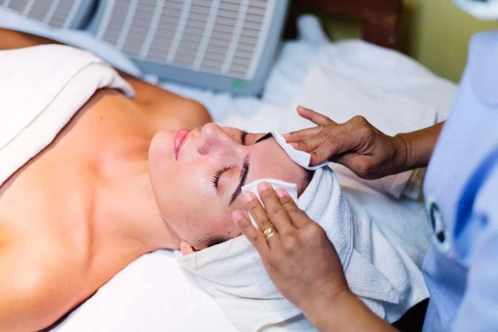 chemical peels